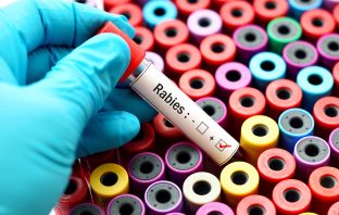 New York State Department of Health Urges New Yorkers to Take Steps to Prevent Rabies Infections During Summer Months
